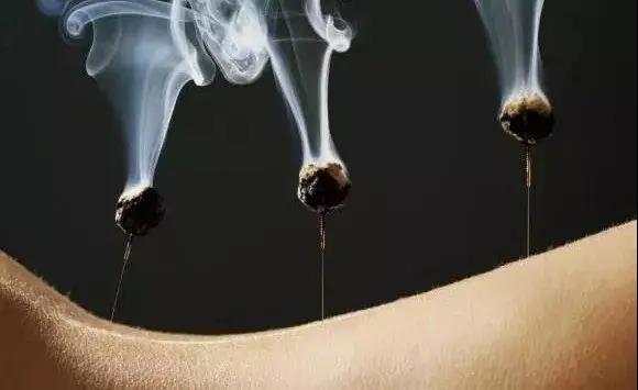 艾灸不是藥，調的不是病，央視為艾灸正名，讓我們正視艾灸