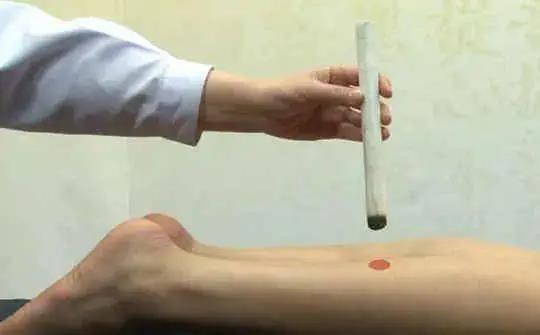 人體“消毒穴”每周艾灸4次，逼出陳年藥毒！