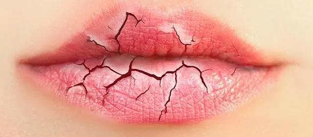嘴唇干裂，或許不是缺水，嘴唇老是干艾灸什么穴位！