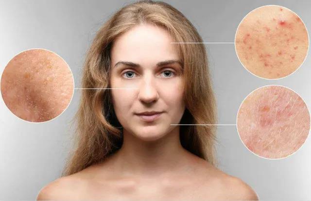 艾灸有美容效果嗎？艾灸哪里能美容