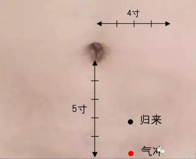 　一艾灸就上火，這是為什么?