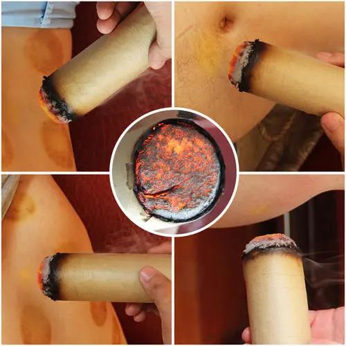 灸溫，到底是燙的好還是溫的好？為什么有的人感覺(jué)不到熱?