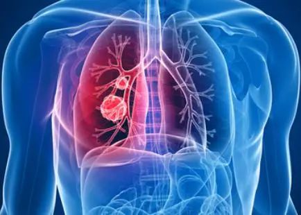 脾胃是健康的根，脾胃和口眼耳鼻、以及五臟的關(guān)聯(lián)全在這！