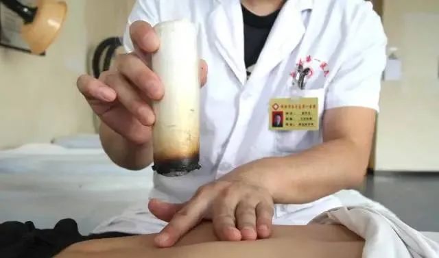 產(chǎn)后艾灸一個(gè)月，十年少生??！ 