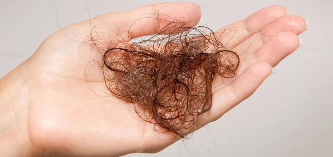 你脫的不是發(fā)，是氣血！艾灸拯救脫發(fā)危機！