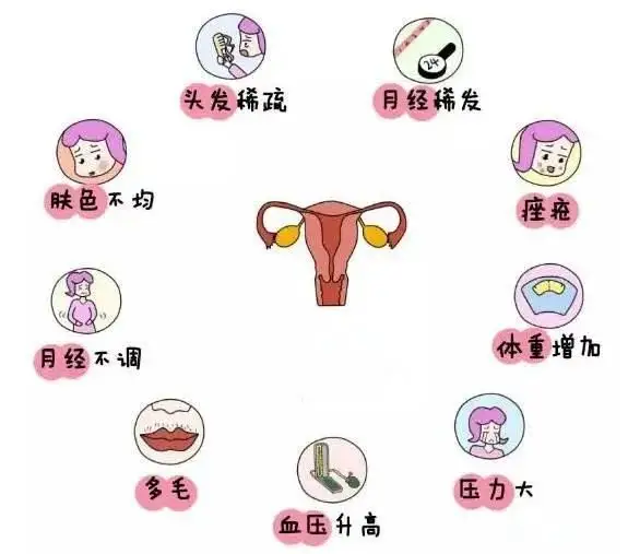 10個(gè)女人就有1個(gè)患多囊！被它纏上不要怕，艾灸幫你調“多囊”！